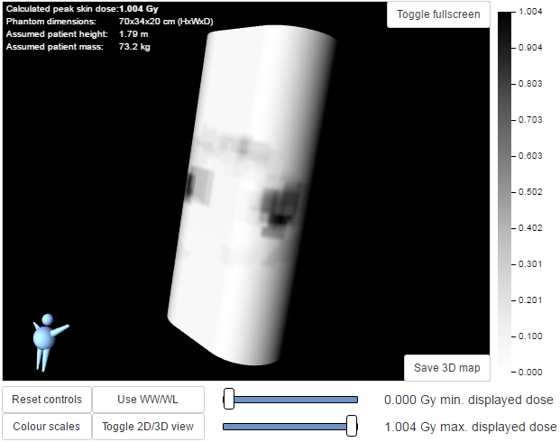 3D visualisation of the skin dose map data
